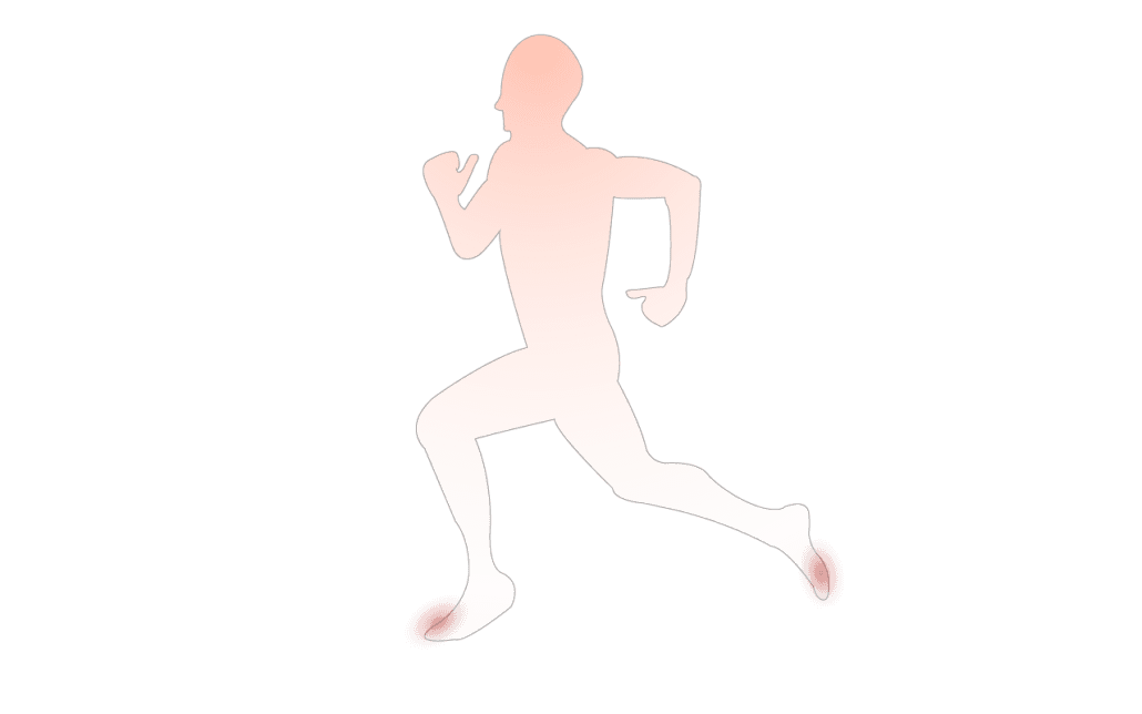 Runner running the London Marathon with Bunions